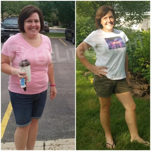 Gastric Band to Gastric Sleeve Revision